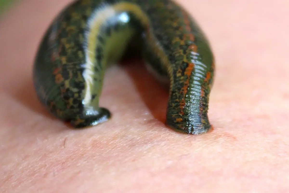 A macro shot of leech actively sucking blood from human skin.