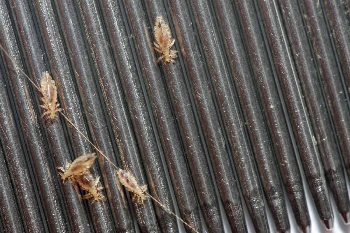 Close-up of a Head lice infestation.